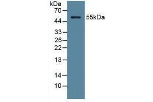 Detection of ODC in Human Serum using Polyclonal Antibody to Ornithine Decarboxylase (ODC) (ODC1 抗体  (AA 15-259))