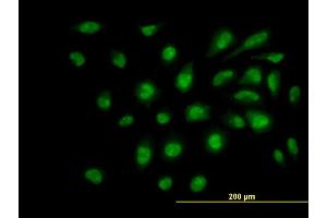 Immunofluorescence of monoclonal antibody to SUPT5H on HeLa cell. (SUPT5H 抗体  (AA 981-1087))