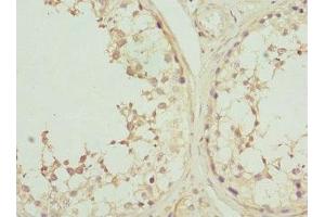 Immunohistochemistry of paraffin-embedded human testis tissue using ABIN7146876 at dilution of 1:100 (Casein Kinase 1 gamma 2 抗体  (Isoform gamma 2))