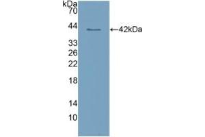 Western blot analysis of recombinant Human CLEC4L. (DC-SIGN/CD209 抗体  (AA 70-404))