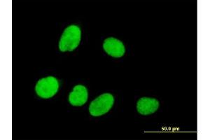 Immunofluorescence of purified MaxPab antibody to RPRD1A on HeLa cell.
