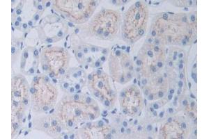 DAB staining on IHC-P; Samples: Rat Kidney Tissue (Adipsin 抗体  (AA 1-263))