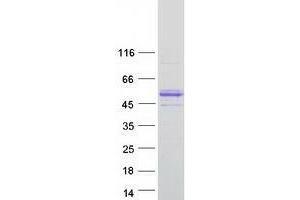 Von Willebrand Factor A Domain Containing 1 (VWA1) (Transcript Variant 1) protein (Myc-DYKDDDDK Tag)