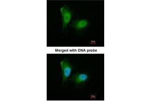 ICC/IF Image Immunofluorescence analysis of paraformaldehyde-fixed HeLa, using 20S Proteasome alpha2, antibody at 1:200 dilution. (PSMA2 抗体  (Center))