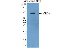 Western blot analysis of the recombinant protein. (Aquaporin 8 抗体  (AA 129-228))