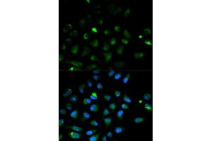 Immunofluorescence analysis of HeLa cell using PRF1 antibody. (Perforin 1 抗体  (AA 280-555))