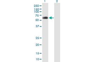 Western Blot analysis of SPAG8 expression in transfected 293T cell line by SPAG8 MaxPab polyclonal antibody. (SPAG8 抗体  (AA 1-501))