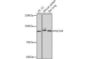 Western blot analysis of extracts of various cell lines, using MCM4 Rabbit mAb (ABIN7268545) at 1:1000 dilution. (MCM4 抗体)