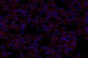 Immunofluorescent analysis of paraformaldehyde-fixed mouse lung using,GNE (ABIN7074056) at dilution of 1: 600 (GNE 抗体)