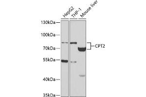 Western blot analysis of extracts of various cell lines, using CPT2 antibody (ABIN3023423, ABIN3023424, ABIN3023425 and ABIN6219865) at 1:400 dilution. (CPT2 抗体)