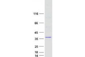 Western Blotting (WB) image for TatD DNase Domain Containing 3 (TATDN3) (Transcript Variant 2) protein (Myc-DYKDDDDK Tag) (ABIN2733249)