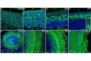 Dvl-2 is expressed in OSN, in all layers through the olfactory bulb and is associated with synapses inside the glomeruli. (DVL2 抗体  (Internal Region))