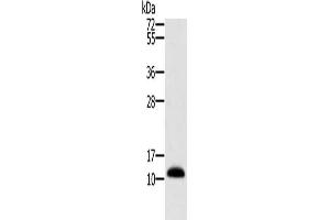Gel: 10 % SDS-PAGE, Lysate: 40 μg, Lane: Human prostate tissue, Primary antibody: ABIN7130278(MSMB Antibody) at dilution 1/250, Secondary antibody: Goat anti rabbit IgG at 1/8000 dilution, Exposure time: 1 second (MSMB 抗体)