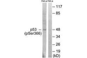 Western blot analysis of extracts from HeLa cells treated with Adriamycin 0. (p53 抗体  (pSer366))