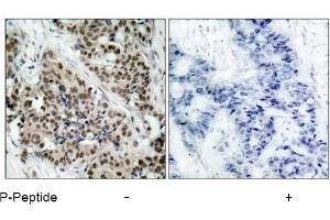 Image no. 3 for anti-Forkhead Box O1 (FOXO1) (pSer256) antibody (ABIN196813) (FOXO1 抗体  (pSer256))