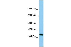 WB Suggested Anti-Spa17 Antibody Titration: 1. (SPA17 抗体  (Middle Region))