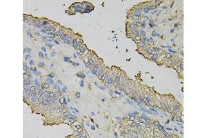 Immunohistochemistry of paraffin-embedded Human prostate using AZGP1 Polyclonal Antibody at dilution of 1:100 (40x lens). (AZGP1 抗体)