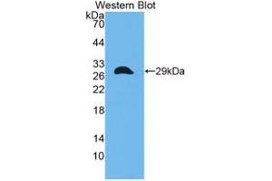 Western blot analysis of the recombinant protein. (CITED1 抗体  (C-Term))
