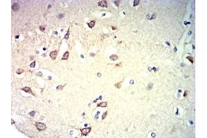 Immunohistochemical analysis of paraffin-embedded brain tissues using CD57 mouse mAb with DAB staining. (CD57 抗体  (AA 28-334))