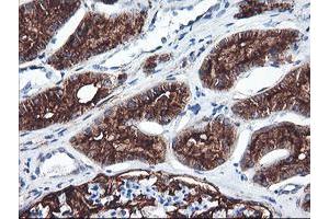 Immunohistochemical staining of paraffin-embedded Human Kidney tissue using anti-ENPEP mouse monoclonal antibody. (ENPEP 抗体)