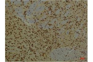 Immunohistochemical analysis of paraffin-embedded Mouse BrainTissue using HIF-1 β/ARNT Mouse mAb diluted at 1:200. (ARNT 抗体)