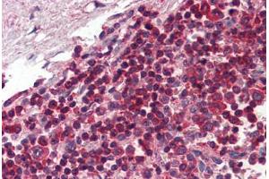 Human Spleen (formalin-fixed, paraffin-embedded) stained with TLR8 antibody ABIN334256 at 5 ug/ml followed by biotinylated anti-mouse IgG secondary antibody ABIN481714, alkaline phosphatase-streptavidin and chromogen. (TLR8 抗体  (AA 750-850))