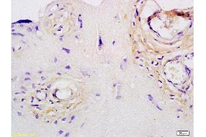 Immunohistochemistry (Paraffin-embedded Sections) (IHC (p)) image for anti-Collagen, Type III (COL3) (AA 801-900) antibody (ABIN730168)