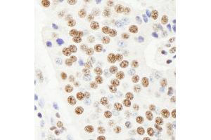 Immunohistochemistry (IHC) image for anti-Ras-Related GTP Binding A (RRAGA) (AA 544-594) antibody (ABIN7448966) (RRAGA 抗体  (AA 544-594))