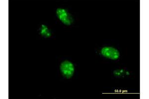 Immunofluorescence of purified MaxPab antibody to C1orf25 on HeLa cell. (TRMT1L 抗体  (AA 1-733))