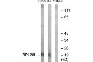 Western blot analysis of extracts from HUVEC cells and MCF-7 cells, using RPL26L antibody. (RPL26L 抗体  (C-Term))