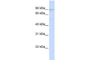 WB Suggested Anti-UBTF Antibody Titration:  0. (UBTF 抗体  (Middle Region))