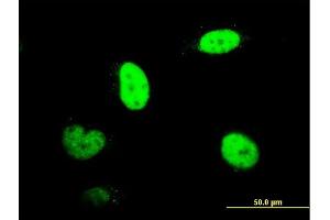 Immunofluorescence of monoclonal antibody to RNUT1 on HeLa cell. (Snurportin 1 抗体  (AA 1-360))