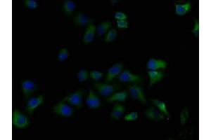 Immunofluorescence staining of Hela cells with ABIN7139916 at 1:50, counter-stained with DAPI. (LPAR5 抗体  (AA 310-326))