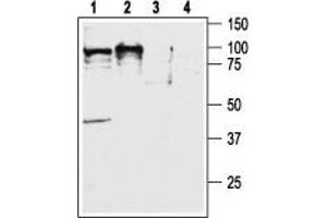 CD200R1 抗体  (C-Term, Intracellular)