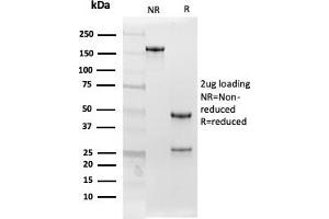SDS-PAGE Analysis Purified Follistatin Mouse Monoclonal Antibody (FST/4282). (Follistatin 抗体)