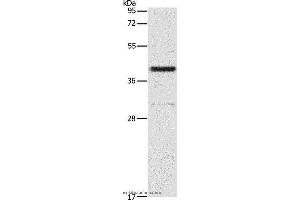 Western blot analysis of 231 cell, using PAFAH2 Polyclonal Antibody at dilution of 1:700 (PAFAH2 抗体)