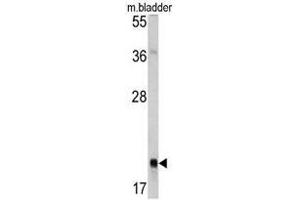 Western blot analysis of RAB13 antibody (Center) in mouse bladder tissue lysates (35ug/lane). (RAB13 抗体  (Middle Region))