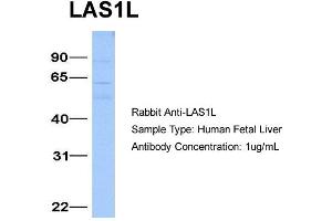 Host:  Rabbit  Target Name:  LAS1L  Sample Type:  Human Fetal Liver  Antibody Dilution:  1. (LAS1L 抗体  (Middle Region))