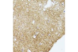 Immunohistochemistry of paraffin-embedded human brain using α-Synuclein Rabbit mAb (ABIN7270695) at dilution of 1:100 (40x lens). (SNCA 抗体  (AA 59-140))