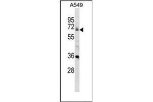 Western blot analysis of DDX28 Antibody (DDX28 抗体  (C-Term))