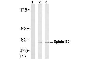 Western blot analysis of extract from H (Ephrin B2 抗体)