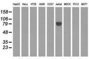Image no. 3 for anti-EPM2A (Laforin) Interacting Protein 1 (EPM2AIP1) antibody (ABIN1498043)