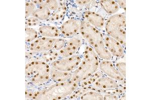 Immunohistochemistry of paraffin-embedded mouse kidney using Phospho-Smad2-S465/467 + Smad3-S423/425 Rabbit pAb (ABIN6135314, ABIN6136248, ABIN6136249 and ABIN6225575) at dilution of 1:50 (40x lens). (SMAD2 / SMAD3 (pSer423), (pSer425) 抗体)