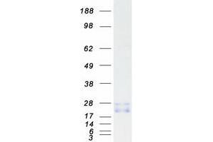 Western Blotting (WB) image for Ras-Related C3 Botulinum Toxin Substrate 3 (Rho Family, Small GTP Binding Protein Rac3) (RAC3) protein (Myc-DYKDDDDK Tag) (ABIN2730393)