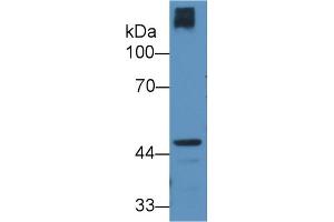 Detection of CRTAP in Human Hela cell lysate using Polyclonal Antibody to Cartilage Associated Protein (CRTAP) (CRTAP 抗体  (AA 26-400))