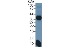Detection of HLA-DRB1 in Mouse Spleen lysate using Polyclonal Antibody to HLA Class II Histocompatibility Antigen, DRB1 Beta Chain (HLA-DRB1)