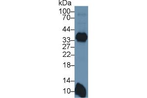Detection of HLA-DRB1 in Mouse Spleen lysate using Polyclonal Antibody to HLA Class II Histocompatibility Antigen, DRB1 Beta Chain (HLA-DRB1) (HLA-DRB1 抗体  (AA 27-264))