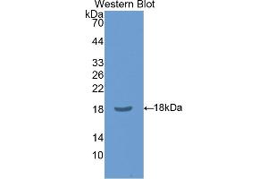 Western blot analysis of the recombinant protein. (CLIC4 抗体  (AA 104-253))