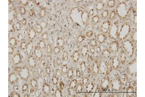 Immunoperoxidase of monoclonal antibody to EXOSC3 on formalin-fixed paraffin-embedded human kidney. (EXOSC3 抗体  (AA 1-275))