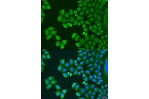 Immunofluorescence analysis of U2OS cells using SYT4 antibody (ABIN6129135, ABIN6148791, ABIN6148792 and ABIN6223676) at dilution of 1:100. (SYT4 抗体  (AA 38-190))